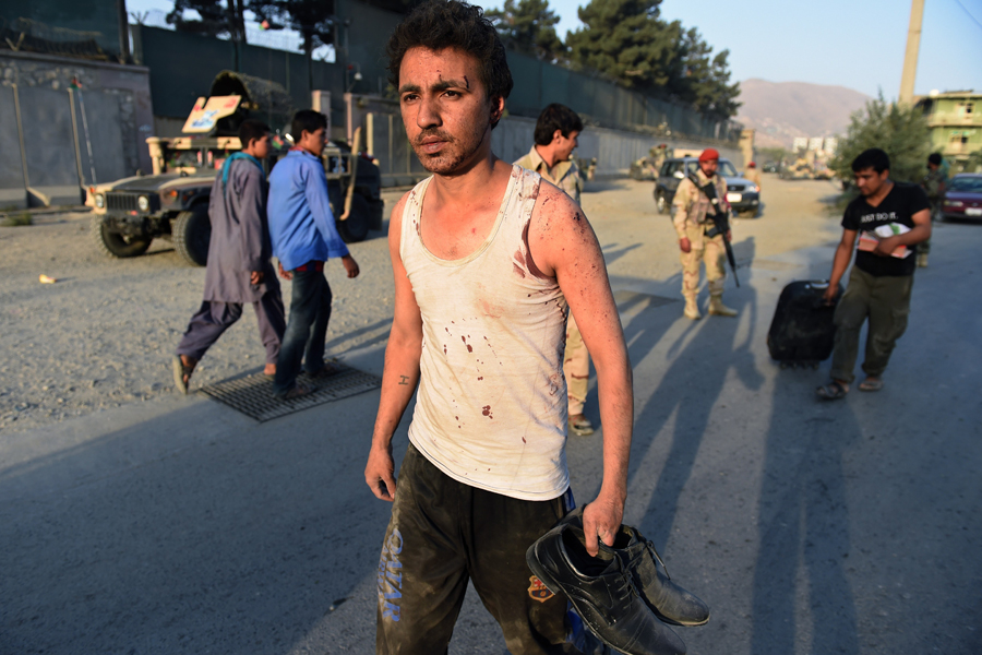 Uno de los perores años para Afganistán en su larga guerra contra los talibanes, que junto a la franquicia de Daesh en suelo afgano son los principales responsable de las muertes. Las cifras hablan por sí solas: 1.094 ataques y 5.312 personas asesinadas. La mayoría de las acciones se producen en la frontera con Pakistán, y la policía suele ser el objetivo más común. En la foto, un hombre herido en un atentado en Kabul. Wakil Kohsar /AFP/Getty Images
