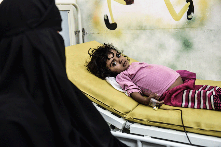 Una niña de 3 años enferma de talasemia y sufriendo malnutrición es atendida en el hospital Yumhuría. El férreo embargo por aire, mar y tierra al que está sujeto Yemen desde marzo de 2015 ha provocado escasez de alimentos y medicación. Julio de 2015/Natalia Sancha